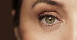 A close-up of a human eye showing detailed skin texture and wrinkles around the eye area