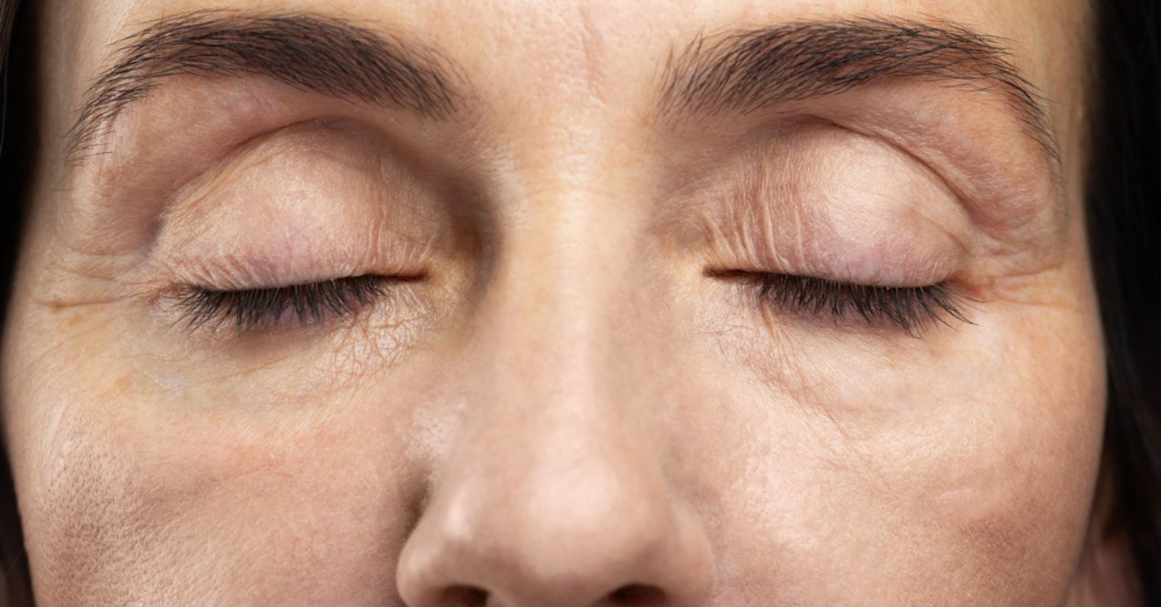 Close-up of a woman's closed eyes showing dehydration lines and wrinkles