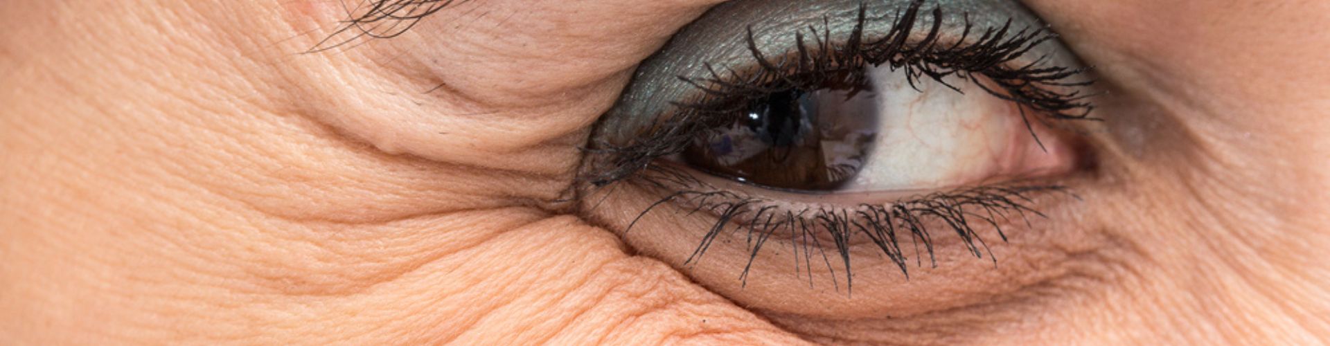 A close-up image of a woman's eye, showing visible crow's feet wrinkles around the outer corner.