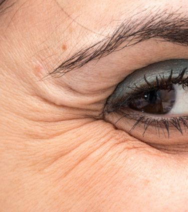 A close-up image of a woman's eye, showing visible crow's feet wrinkles around the outer corner.