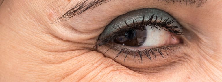 A close-up image of a woman's eye, showing visible crow's feet wrinkles around the outer corner.