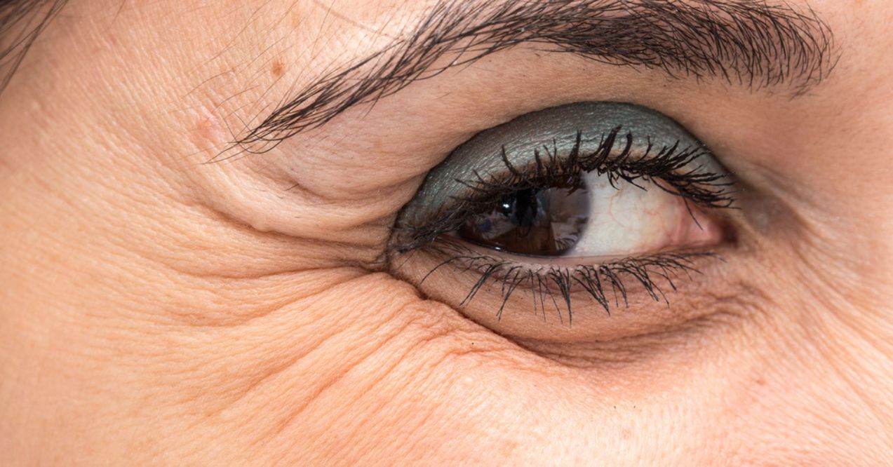 A close-up image of a woman's eye, showing visible crow's feet wrinkles around the outer corner.