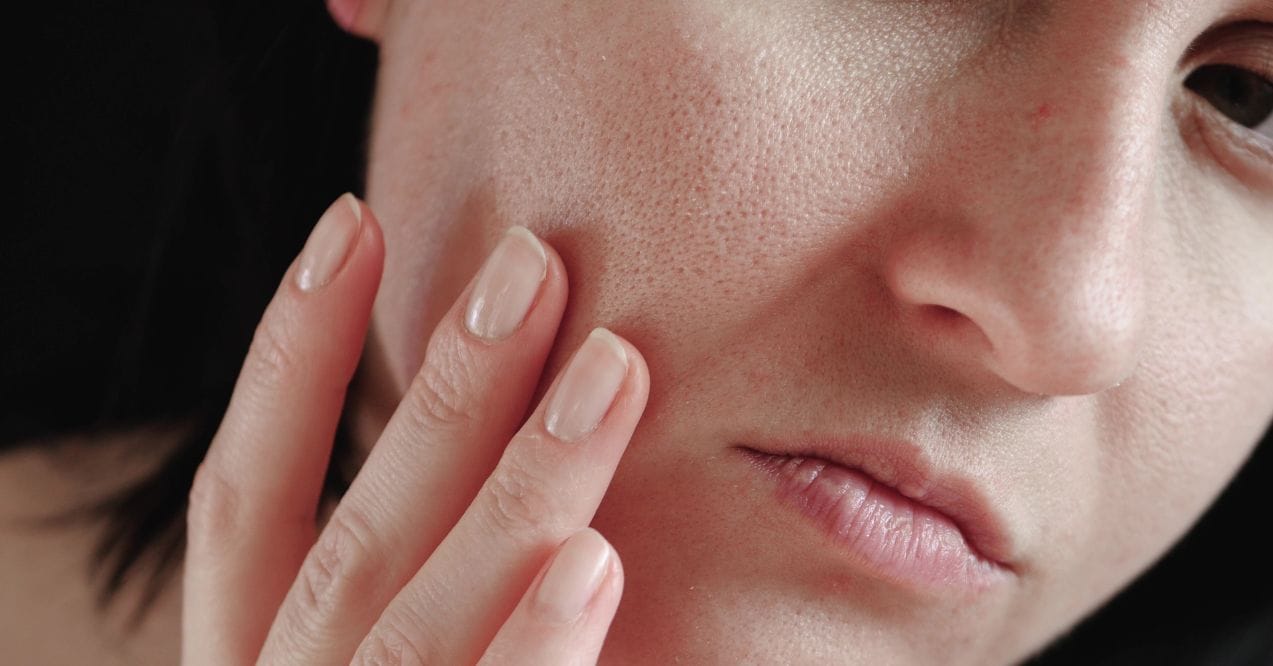 Close-up of a person examining their skin, focusing on visible pores and texture.