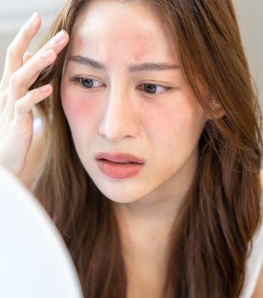 A concerned woman examining redness on her face, exploring the effects of formaldehyde on skin​.