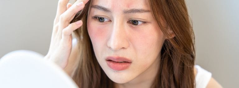 A concerned woman examining redness on her face, exploring the effects of formaldehyde on skin​.