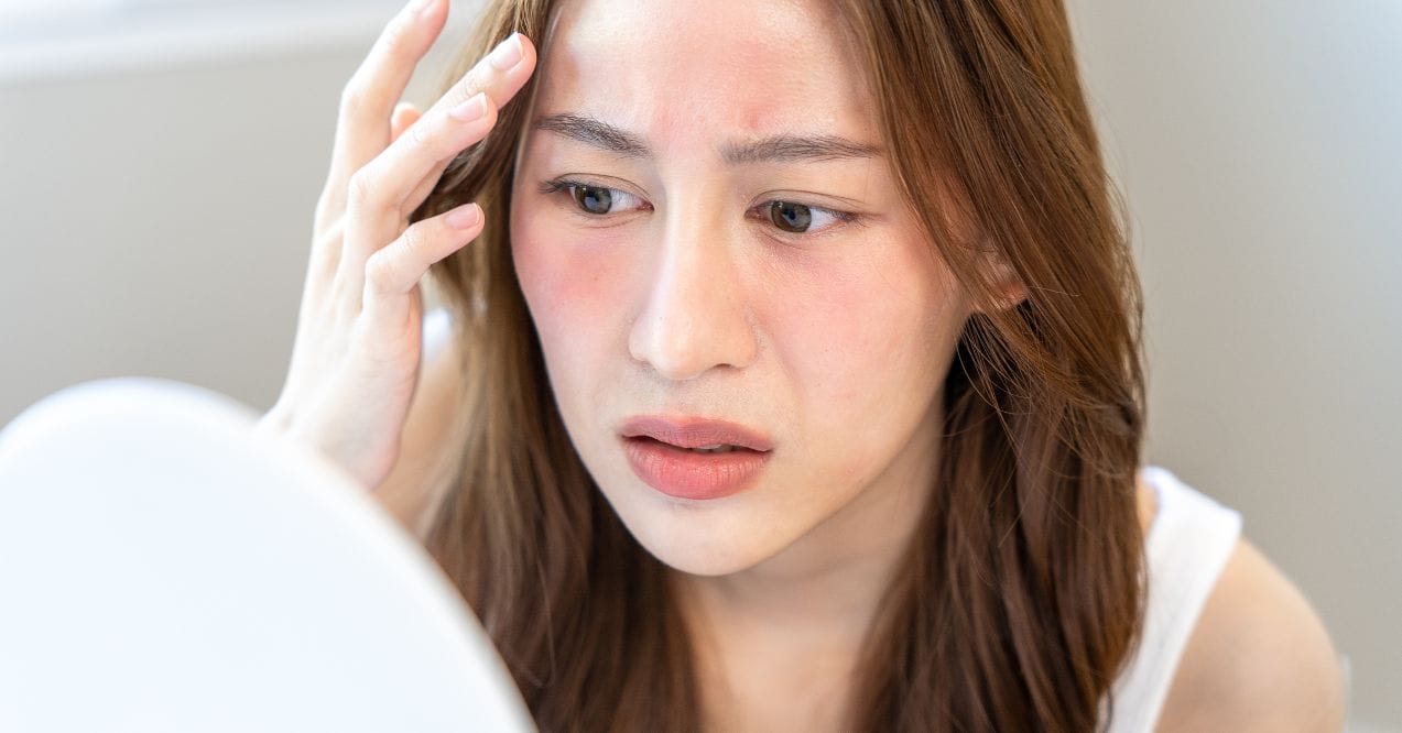 A concerned woman examining redness on her face, exploring the effects of formaldehyde on skin​.