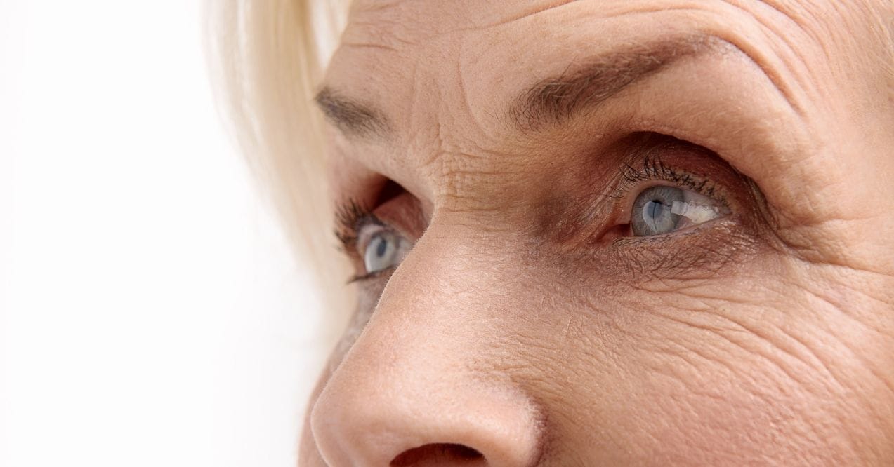 Close-up of crepey skin under eyes
