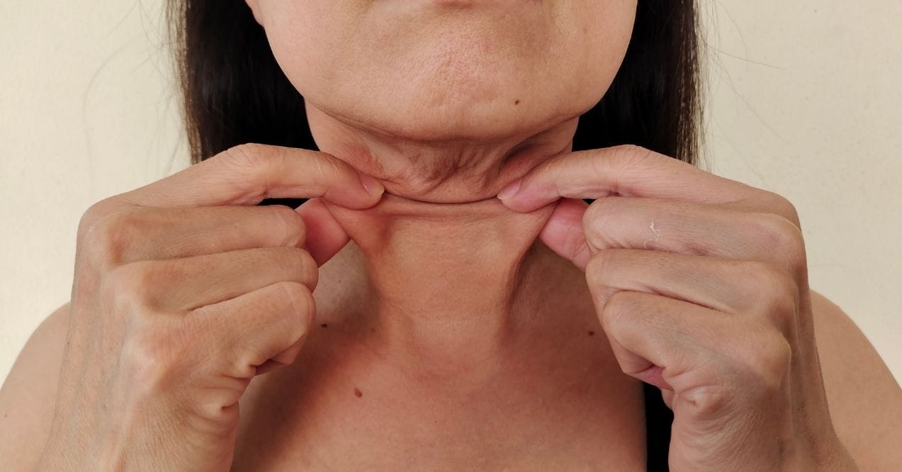 Woman pinching loose neck skin